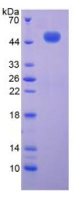 SDS-PAGE (C9-1844M).jpg